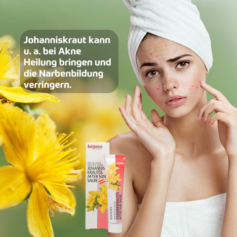 Holzhacker Johanniskrautöl After Sun Salbe 75 ml